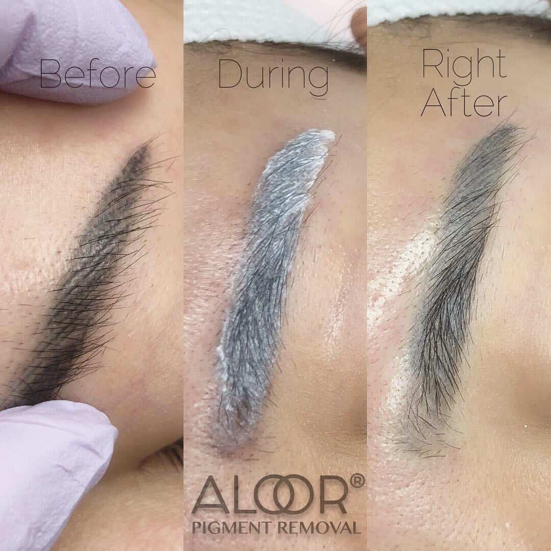Most important facts about Tattoo-Permanent Makeup Remover
