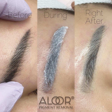 Most important facts about Tattoo-Permanent Makeup Remover